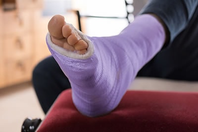 foot and ankle fractures treatment in the St. Charles County, MO: Saint Peters (O'Fallon, St Charles, Wentzville, Lake St Louis, Dardenne Prairie, Cottleville, Weldon Spring) and St. Louis County, MO: Maryland Heights, Bridgeton, Earth City areas